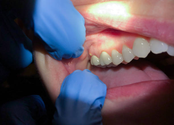 Best After-Hours Emergency Dentist in Crandall, TX